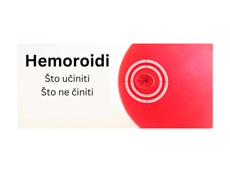 Najbolje i najgore stvari koje možete učiniti protiv hemoroida